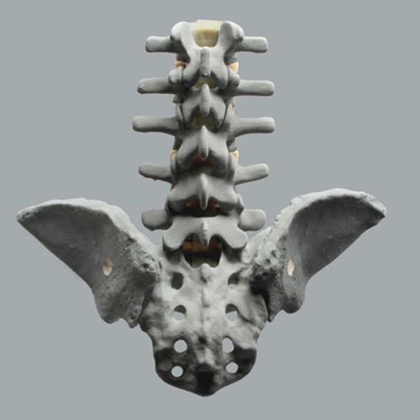Spine, Lumbar, Bilateral Iliac Crests, Radiopaque