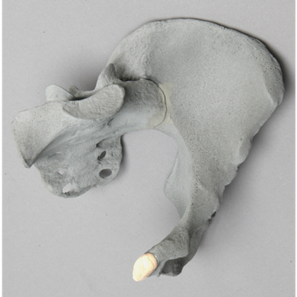 Pelvis, Female Partial, Radiopaque