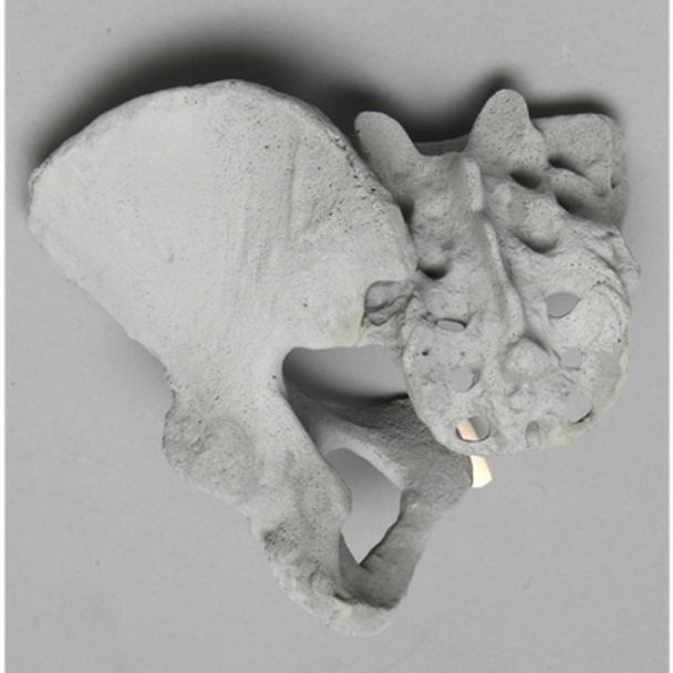 Pelvis, Female Partial, Radiopaque