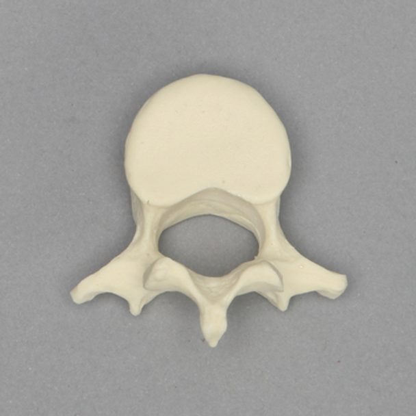 Vertebra, L3, Pediatric, Solid Foam