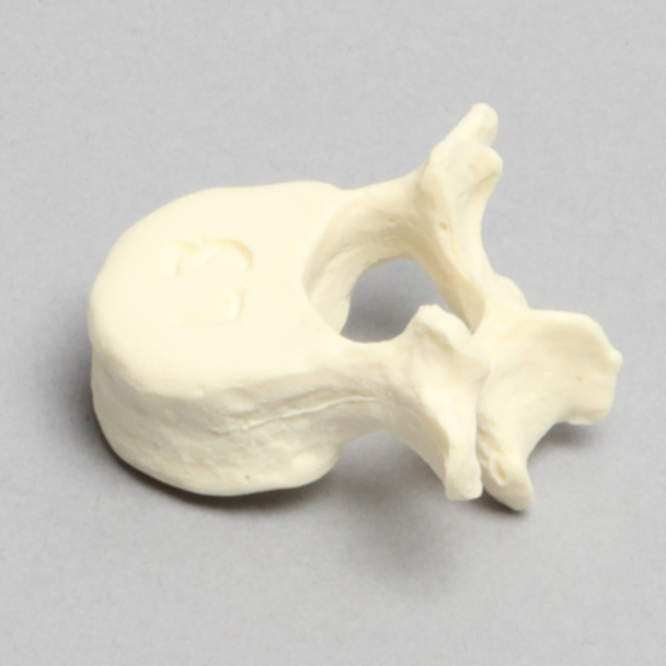 Vertebra, L3, Pediatric, Solid Foam