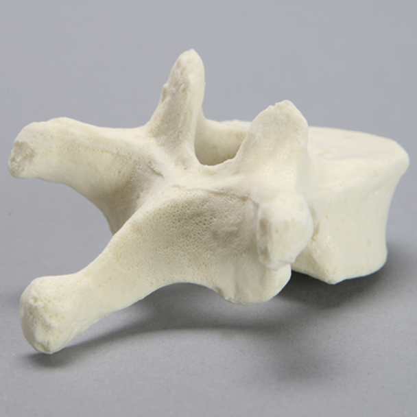 Vertebra, T10, Foam Cortical