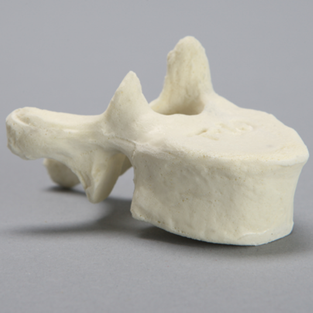 Vertebra, T10, Foam Cortical