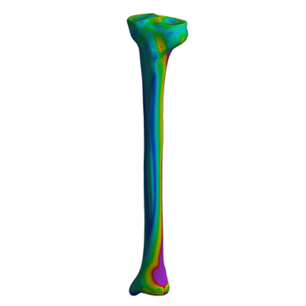 Tibia, Finite Element Model of #3402