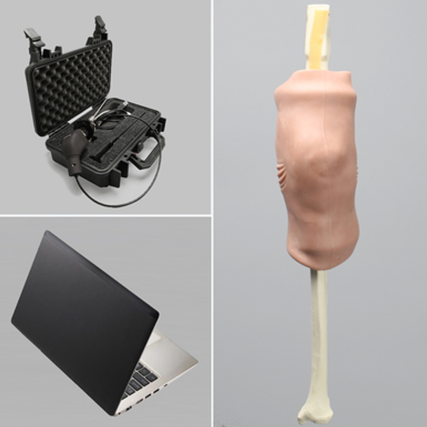 Knee Arthroscopy Bundle Knee Arthroscopy Bundle