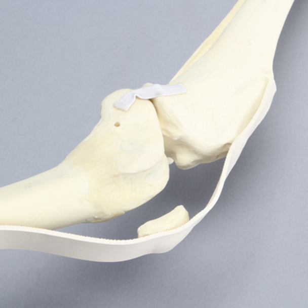 Canine Knee with Ligaments and Pathology Canine Knee with Ligaments and Pathology