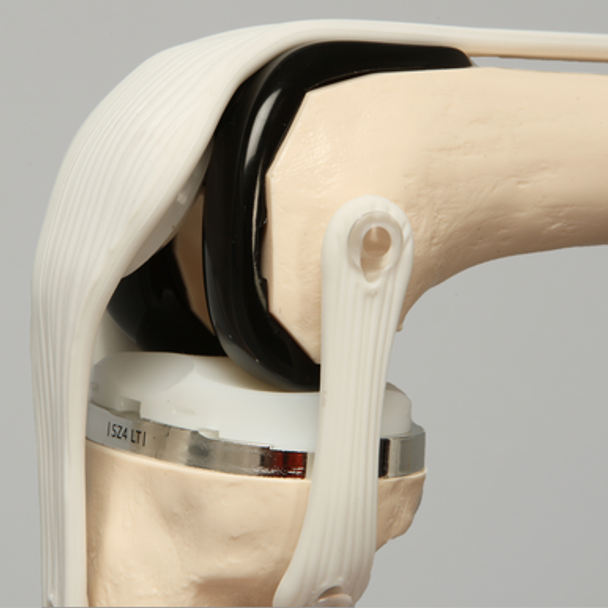 Total Knee Modular Demonstrator