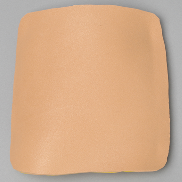 Replacement Lateral Portal