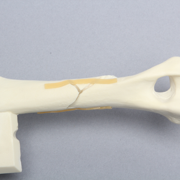 Canine Humerus with Spiral Fracture, Solid Foam