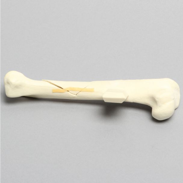 Canine Humerus with Spiral Fracture, Solid Foam