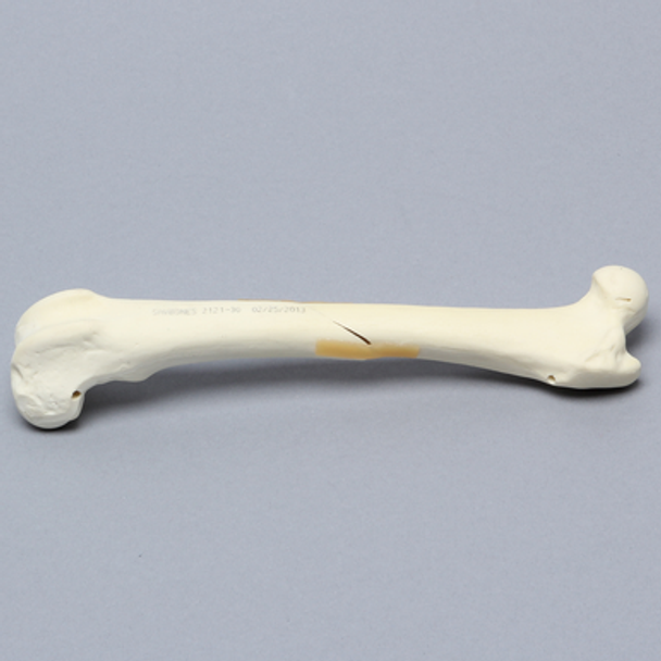 Canine Femur with Fracture