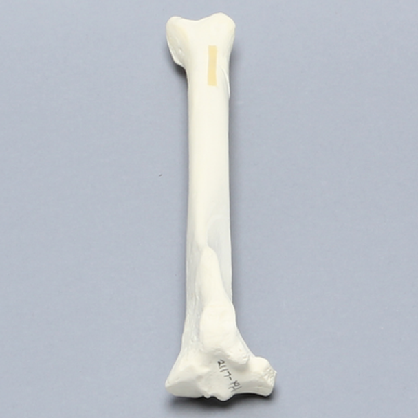 Canine Tibia with Distal Oblique Fracture, Foam Cortical