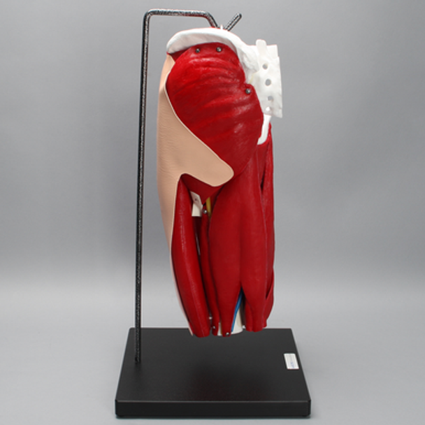 Hip with Full Anatomy