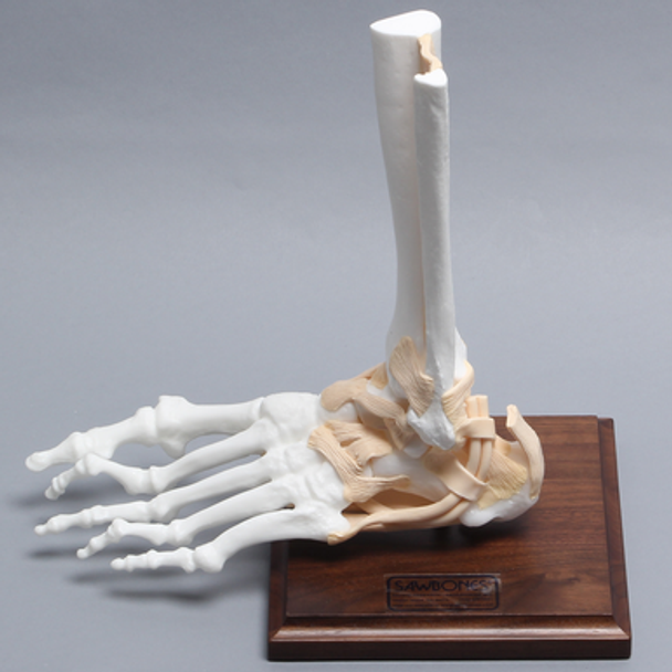 Foot and Ankle with Bunion, Hammertoes, and Heel Spur with Stand