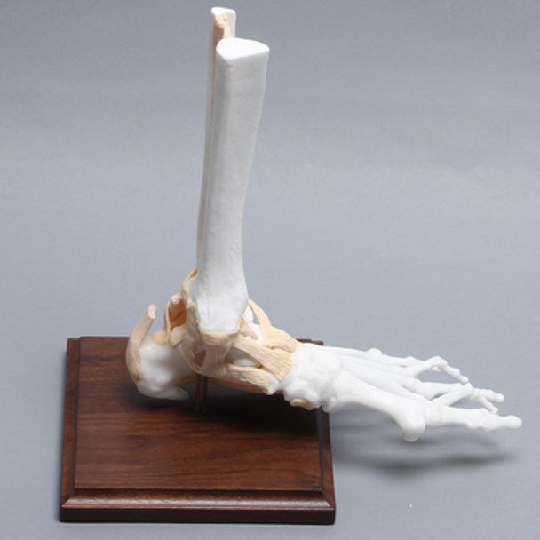 Foot and Ankle with Bunion, Hammertoes, and Heel Spur with Stand