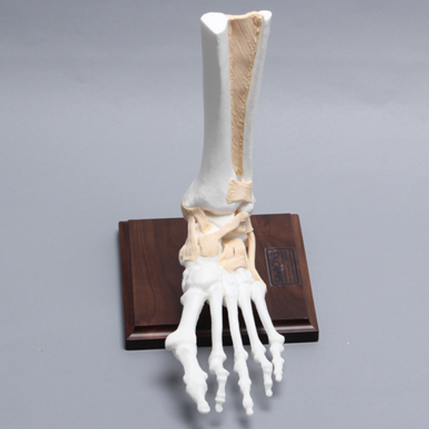 Foot and Ankle with Bunion, Hammertoes, and Heel Spur with Stand