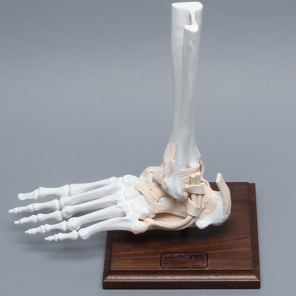 Foot and Ankle, Distal, Tendons and Ligaments with Stand