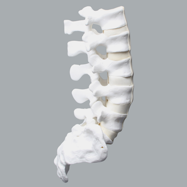 Lumbar Vertebrae, L1-Sacrum, With Ligaments and Discs