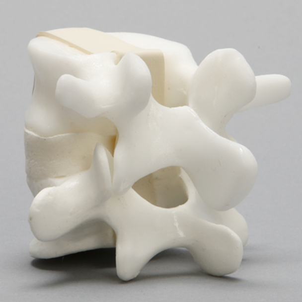 Lumbar Vertebrae, L4-L5, With White Disc