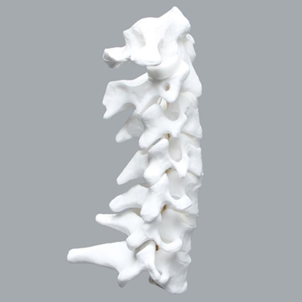 Cervical Spine with Posterior Ligament and White Discs