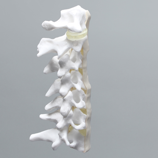 Cervical Spine with Anterior and Posterior Ligaments and Clear Discs