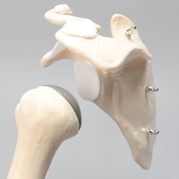 Total Shoulder Demonstrator