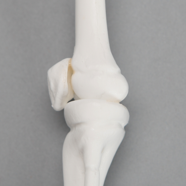 Knee, Pediatric, Solid White Plastic