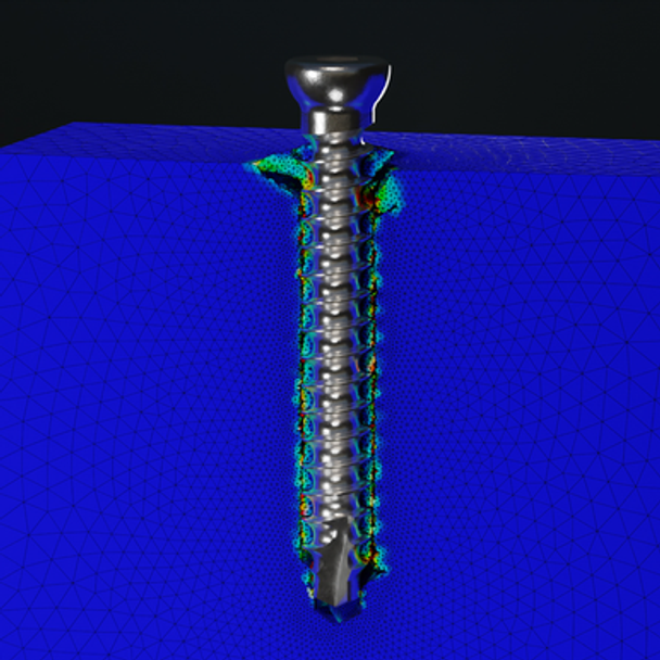 ENDPOINT Virtual Mechanical Test, Grade 10 Axial Pullout Strength