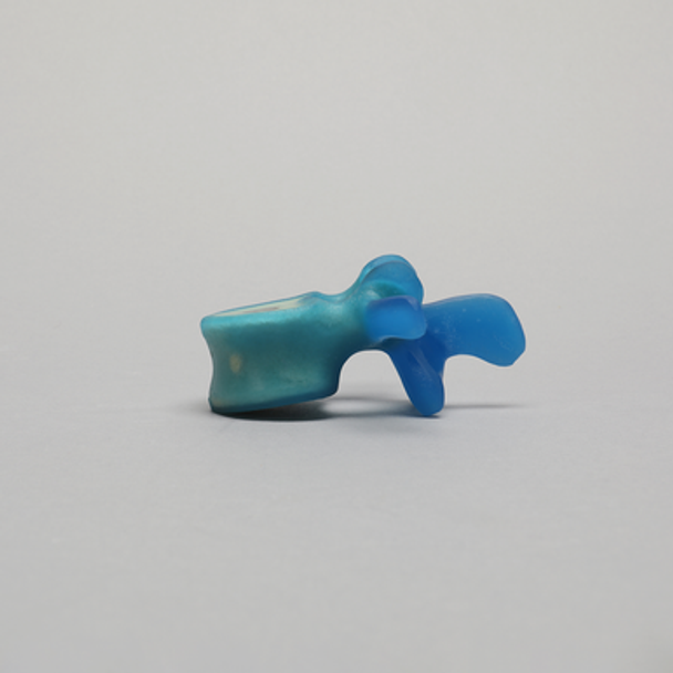 Lumbar L3, absolute™ Osteo with 10 PCF Solid Foam Core, Large