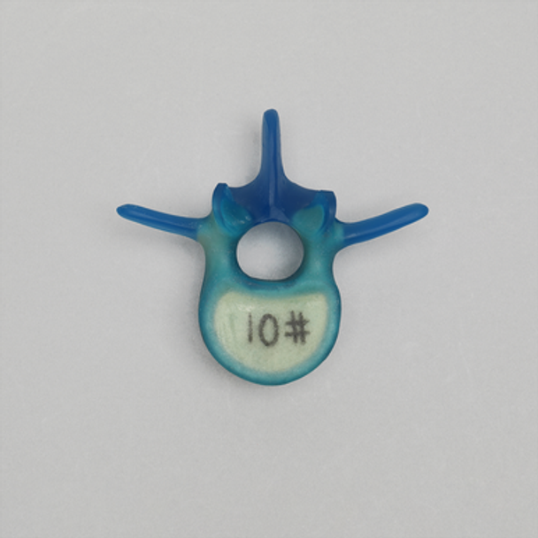 Lumbar L3, absolute™ Osteo with 10 PCF Solid Foam Core, Large