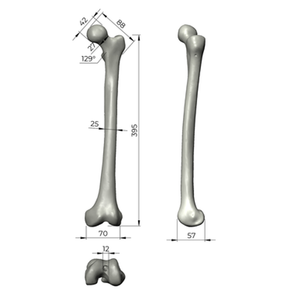 Femur with Average Asian Anatomical Attributes, absolute™ 4th Gen., 17 PCF Solid Foam Core