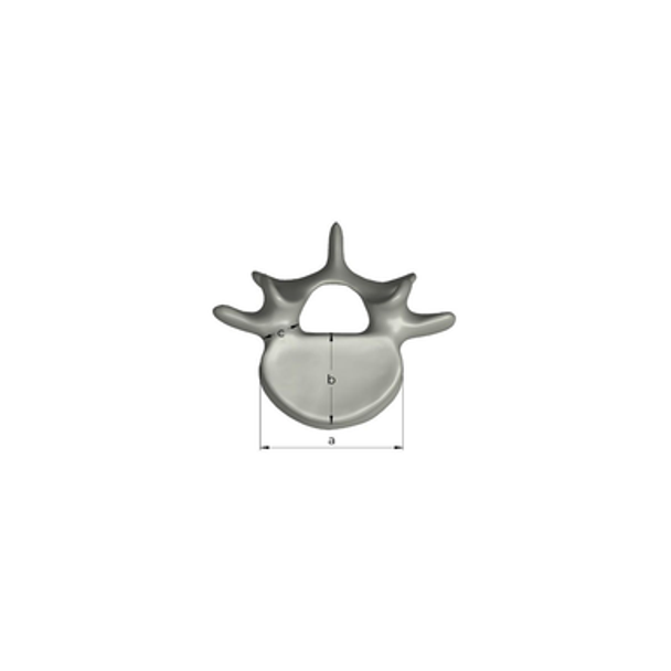 Lumbar L5, absolute™ 4th Gen. with 20 PCF Solid Foam Cancellous