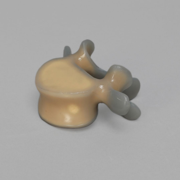Lumbar L5, absolute™ 4th Gen. with 10 PCF Solid Foam Cancellous