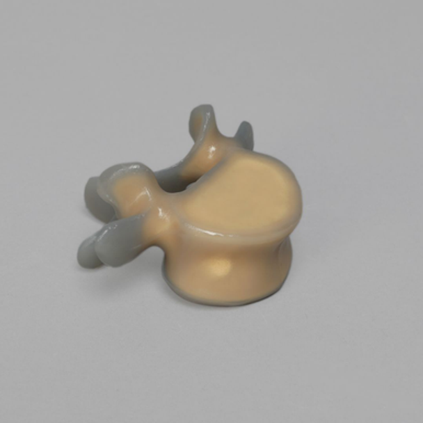 Lumbar L5, absolute™ 4th Gen. with 10 PCF Solid Foam Cancellous