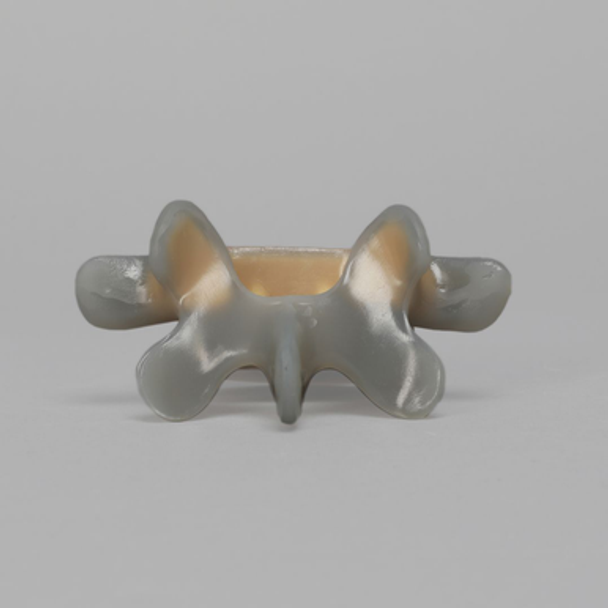 Lumbar L5, absolute™ 4th Gen. with 10 PCF Solid Foam Cancellous