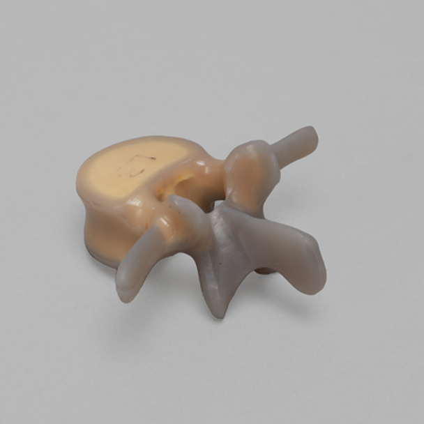 Lumbar L3, absolute™ 4th Gen., 5 PCF Solid Foam Core, Large