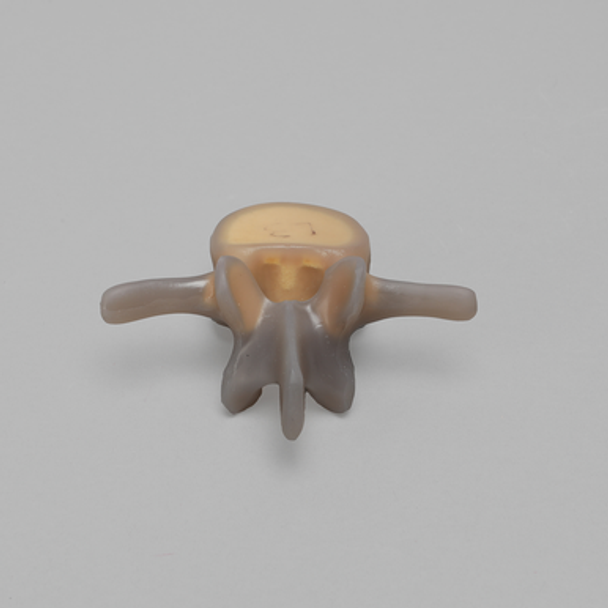 Lumbar L3, absolute™ 4th Gen., 10 PCF Solid Foam Core, Large