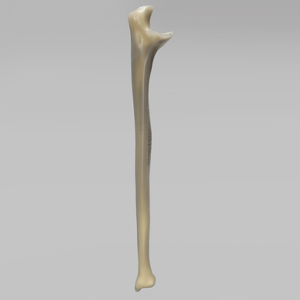 Ulna, absolute™ 4th Gen., 17 PCF Solid Foam Core, Large