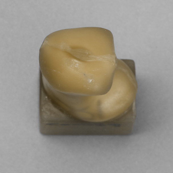 First Metatarsal, absolute™ 4th Gen., 17 PCF Solid Foam Core, Proximal Vise