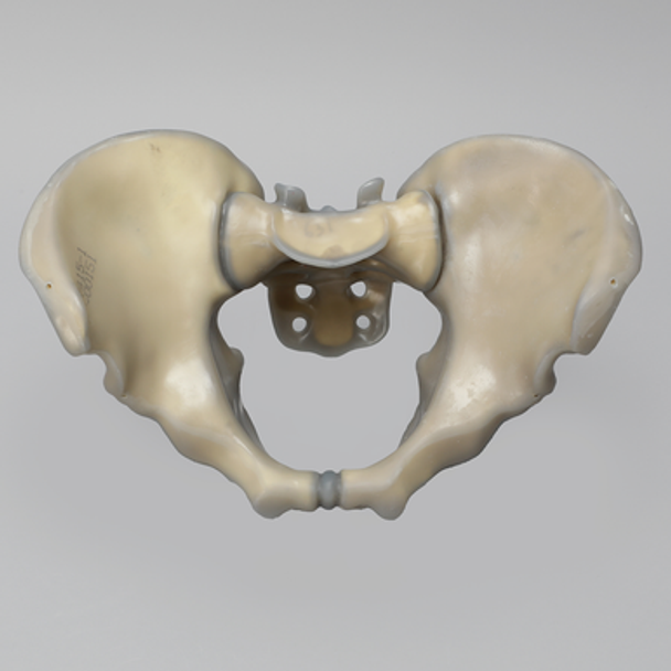 Pelvis with Partial Fusion, absolute™ 4th Gen., 17 PCF Solid Foam Core, Large