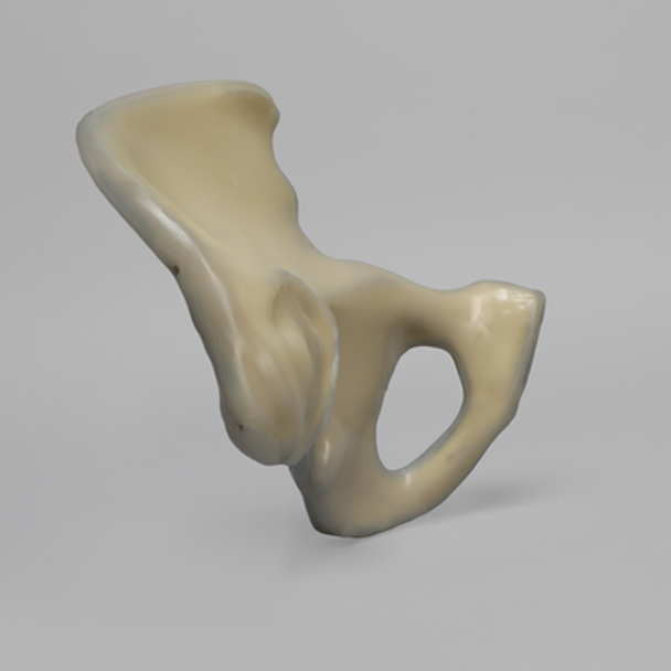 Hemi Pelvis, absolute™ 4th Gen., 17 PCF Solid Foam Core, Large