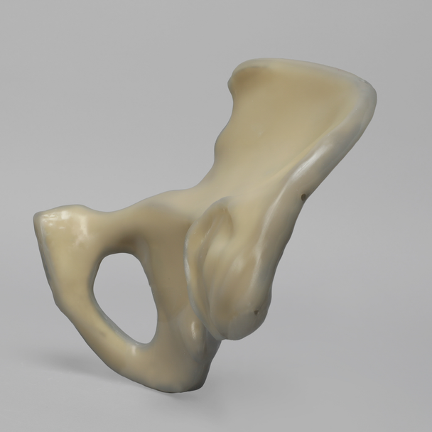 Hemi Pelvis, absolute™ 4th Gen., 17 PCF Solid Foam Core, Large