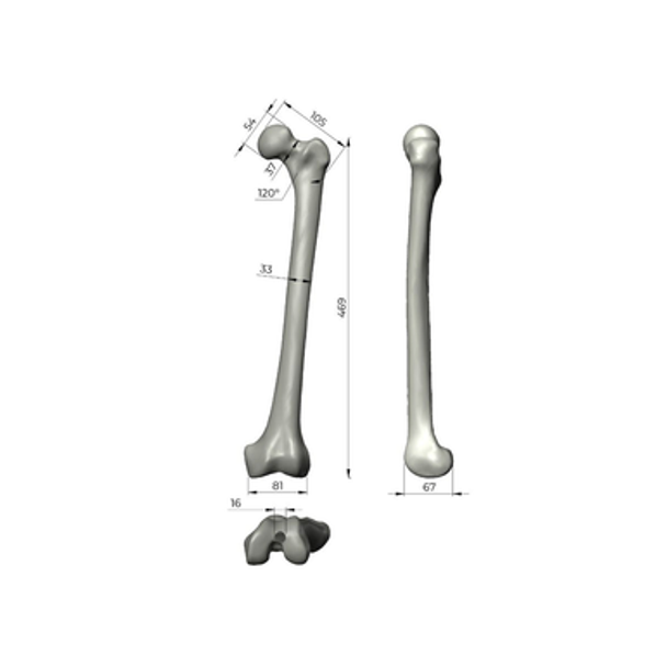 Femur, absolute™ 4th Gen., 17 PCF Solid Foam Cancellous, Large with Distal Cross Pin Filled