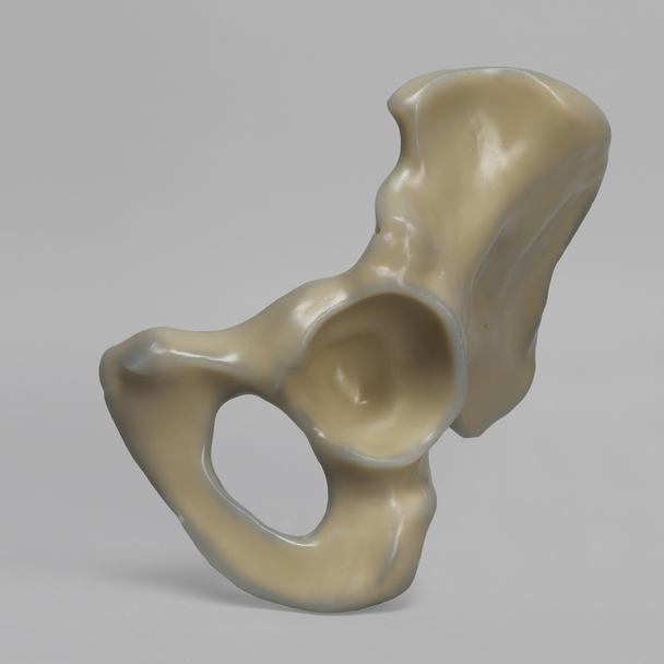 Hemi Pelvis, absolute™ 4th Gen., Composite, 17 PCF Solid Foam Core, Left