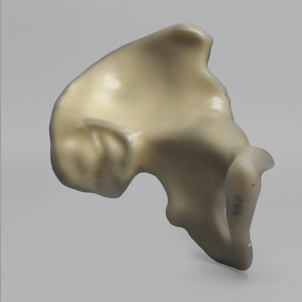 Hemi Pelvis, absolute™ 4th Gen., Composite, 17 PCF Solid Foam Core, Left