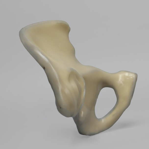 Hemi Pelvis, absolute™ 4th Gen., Composite, 17 PCF Solid Foam Core, Left