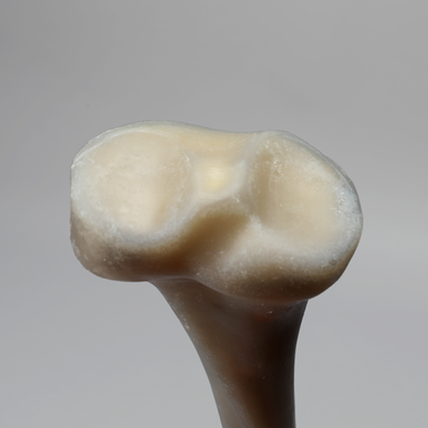 Tibia, absolute™ 4th Gen., 17 PCF, Solid Foam Core with Varus Deformity, Medium