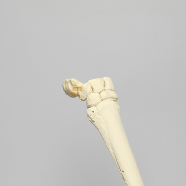 Equine Joint, Carpal Bone Set