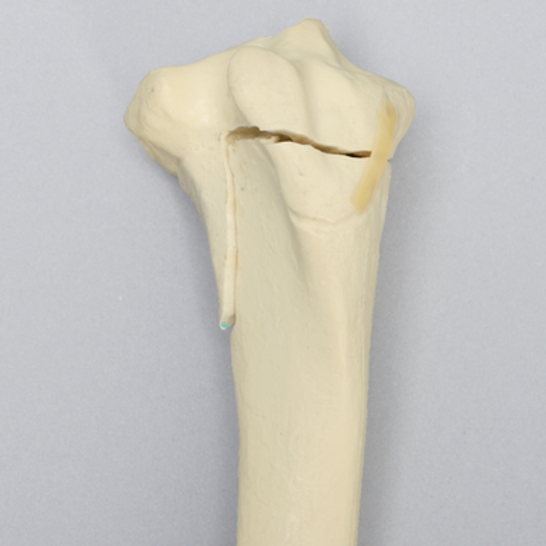 Equine Foal Tibia with Fracture