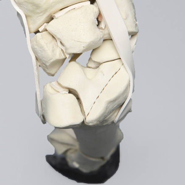 Equine Encased Distal Thoracic Limb with Carpal and Phalanx Fractures